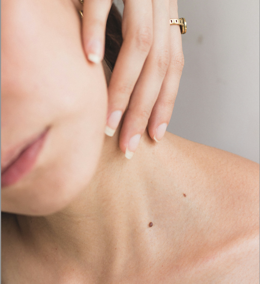 Pharmacist’s Hack: How to Remove Milia & Skin Tags at Home
