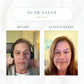 Emogene Signature Scar Salve