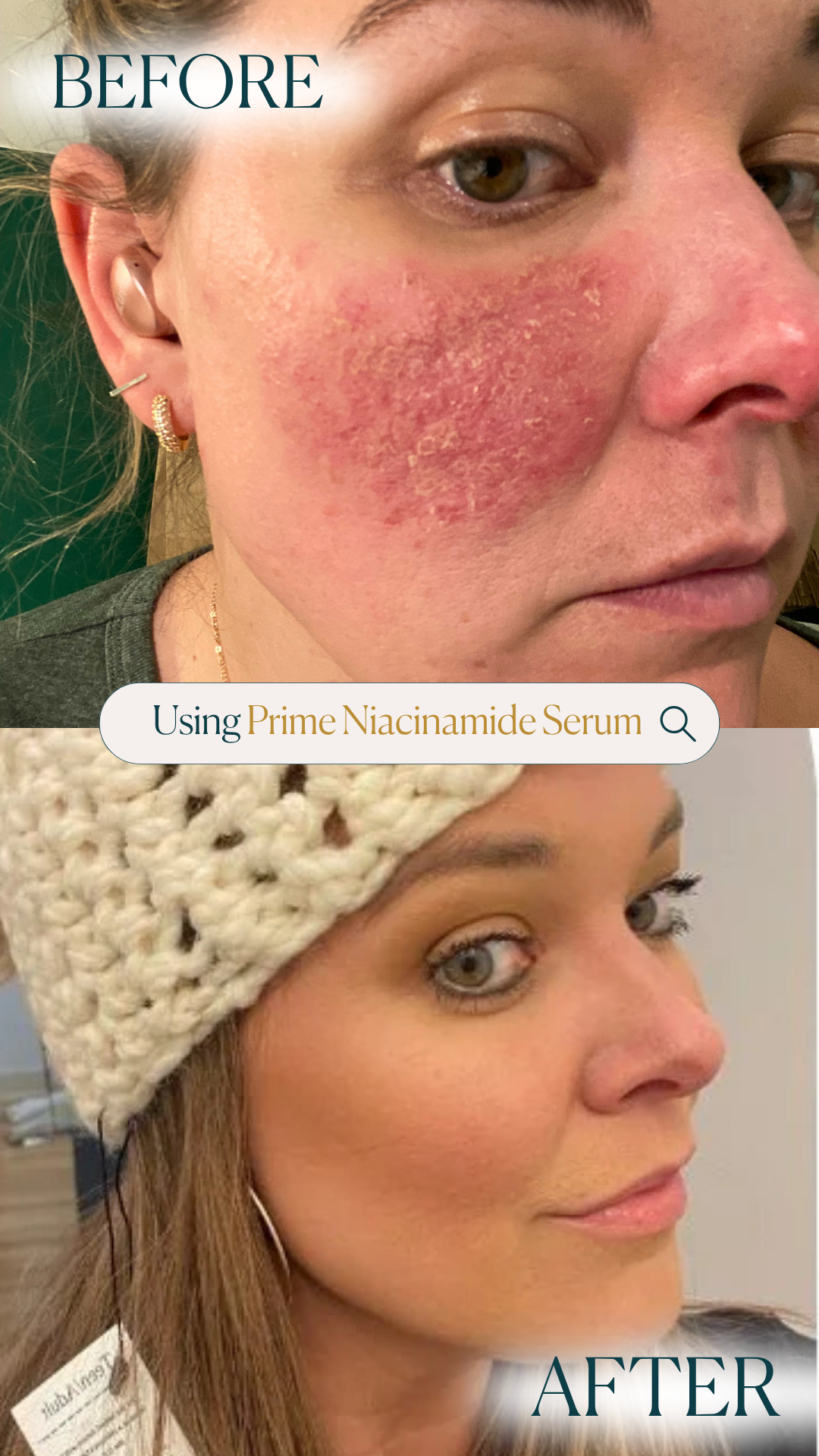 Prime Niacinamide Facial Serum