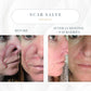 Emogene Signature Scar Salve