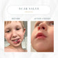 Emogene Signature Scar Salve