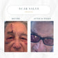 Emogene Signature Scar Salve