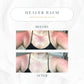 The Healer All Purpose Balm