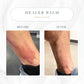 The Healer All Purpose Balm