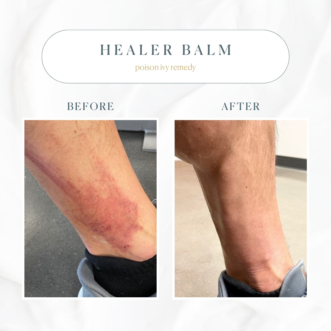 The Healer All Purpose Balm