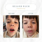 The Healer All Purpose Balm