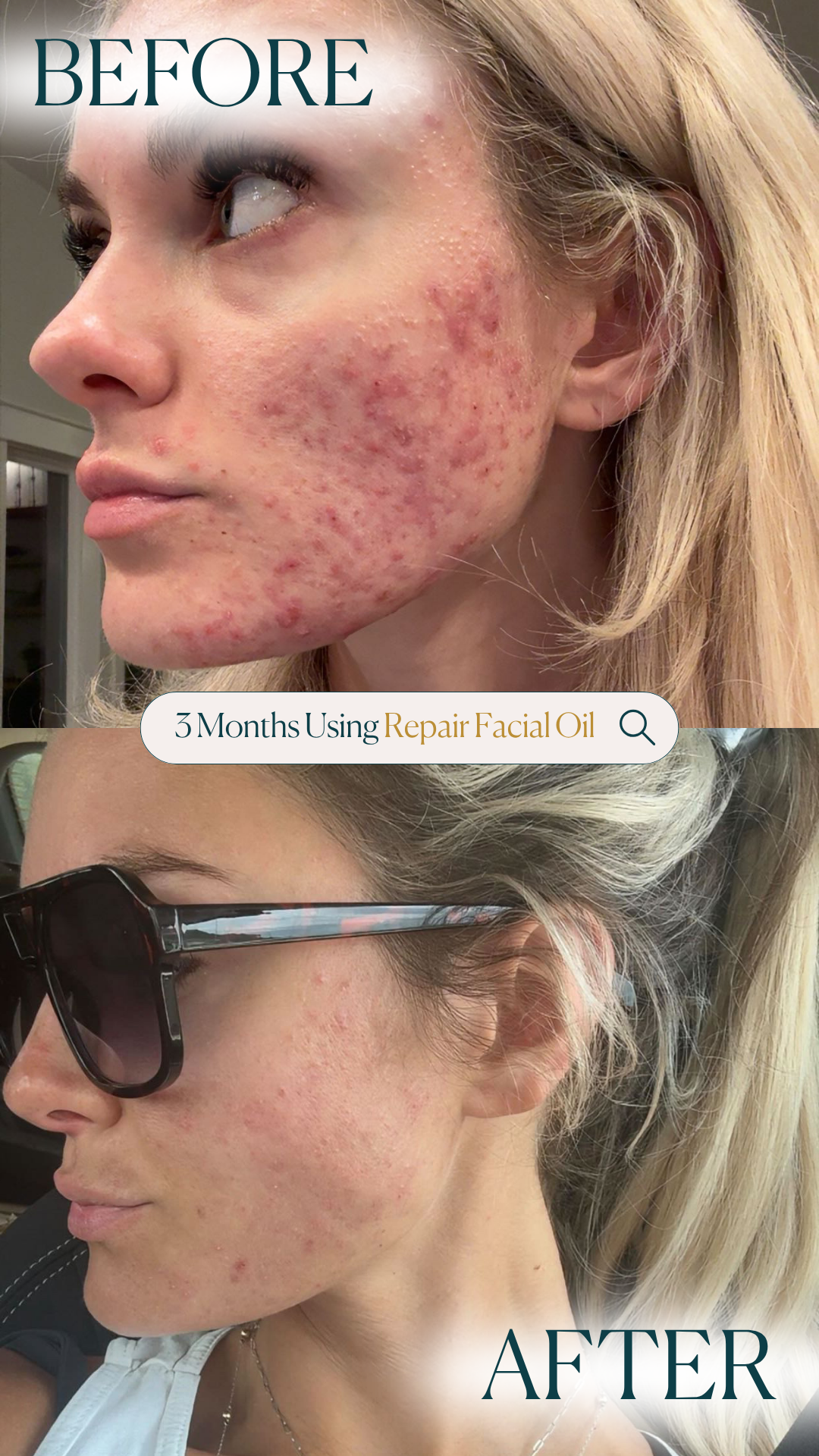 Repair Facial Oil