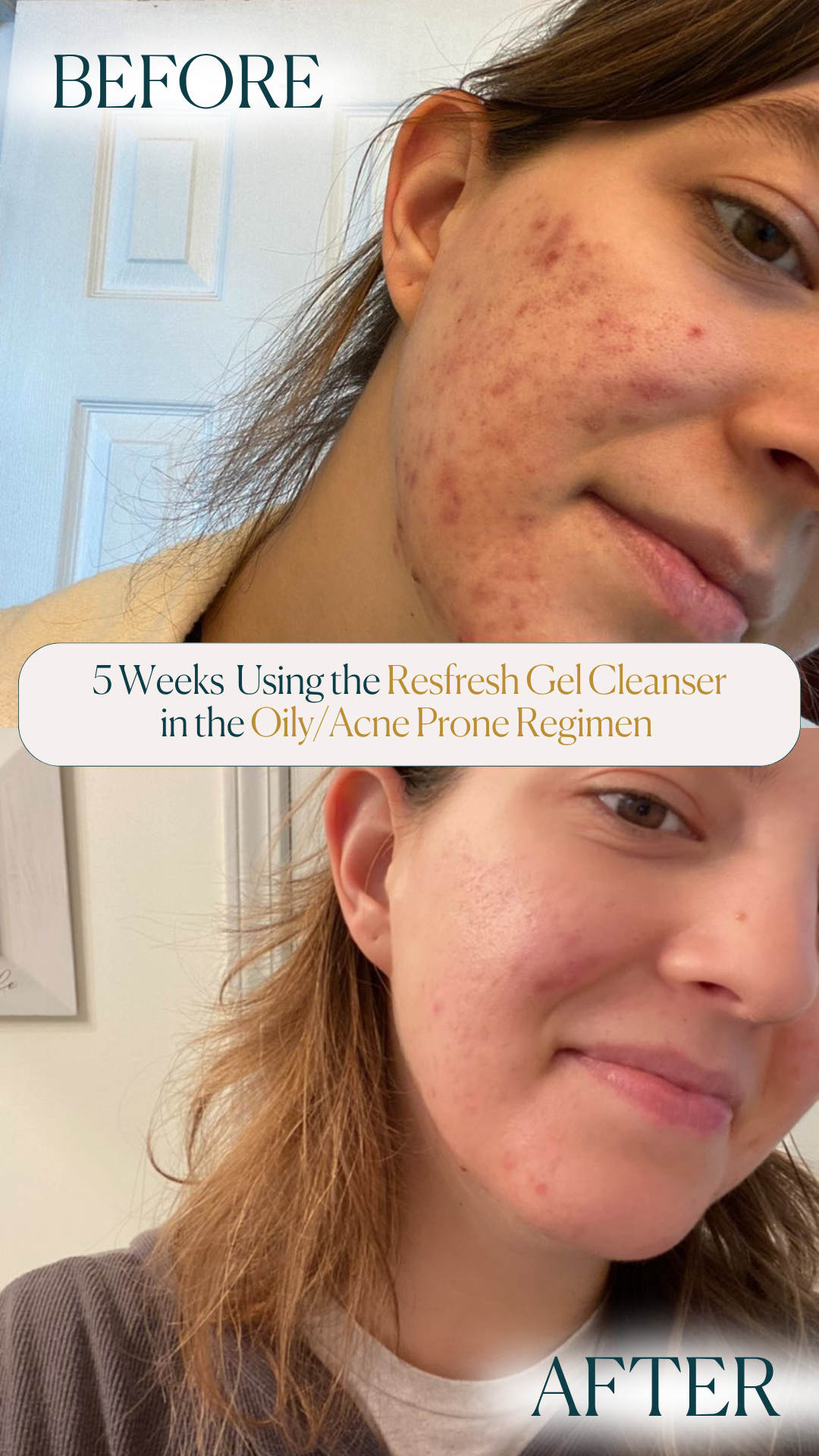 Refresh Gel Cleanser