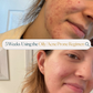 Oily / Acne Prone Skin Basic Regimen