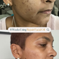 Repair Facial Oil