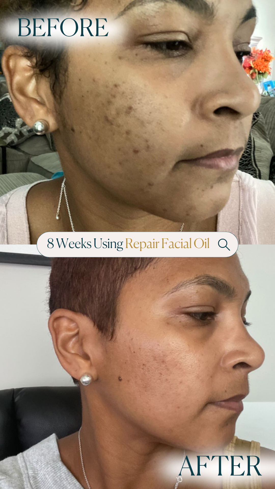 Repair Facial Oil