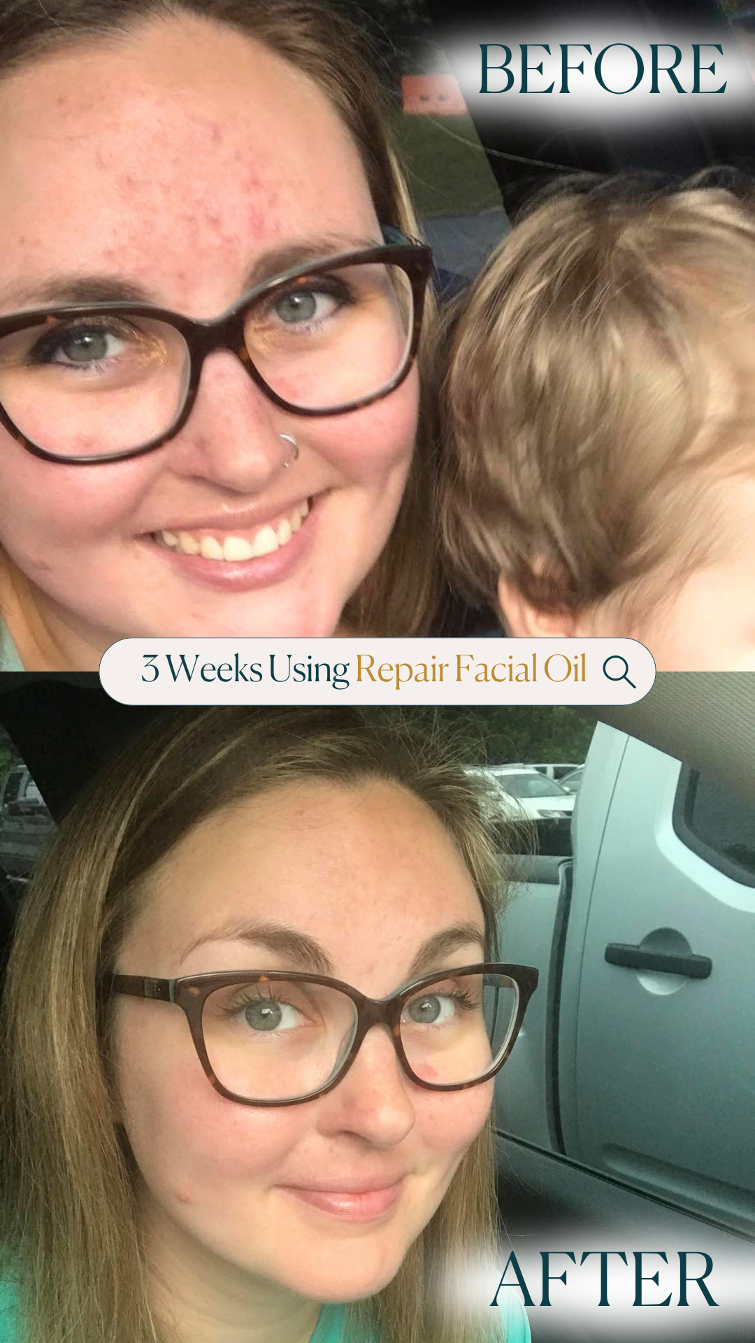 Repair Facial Oil
