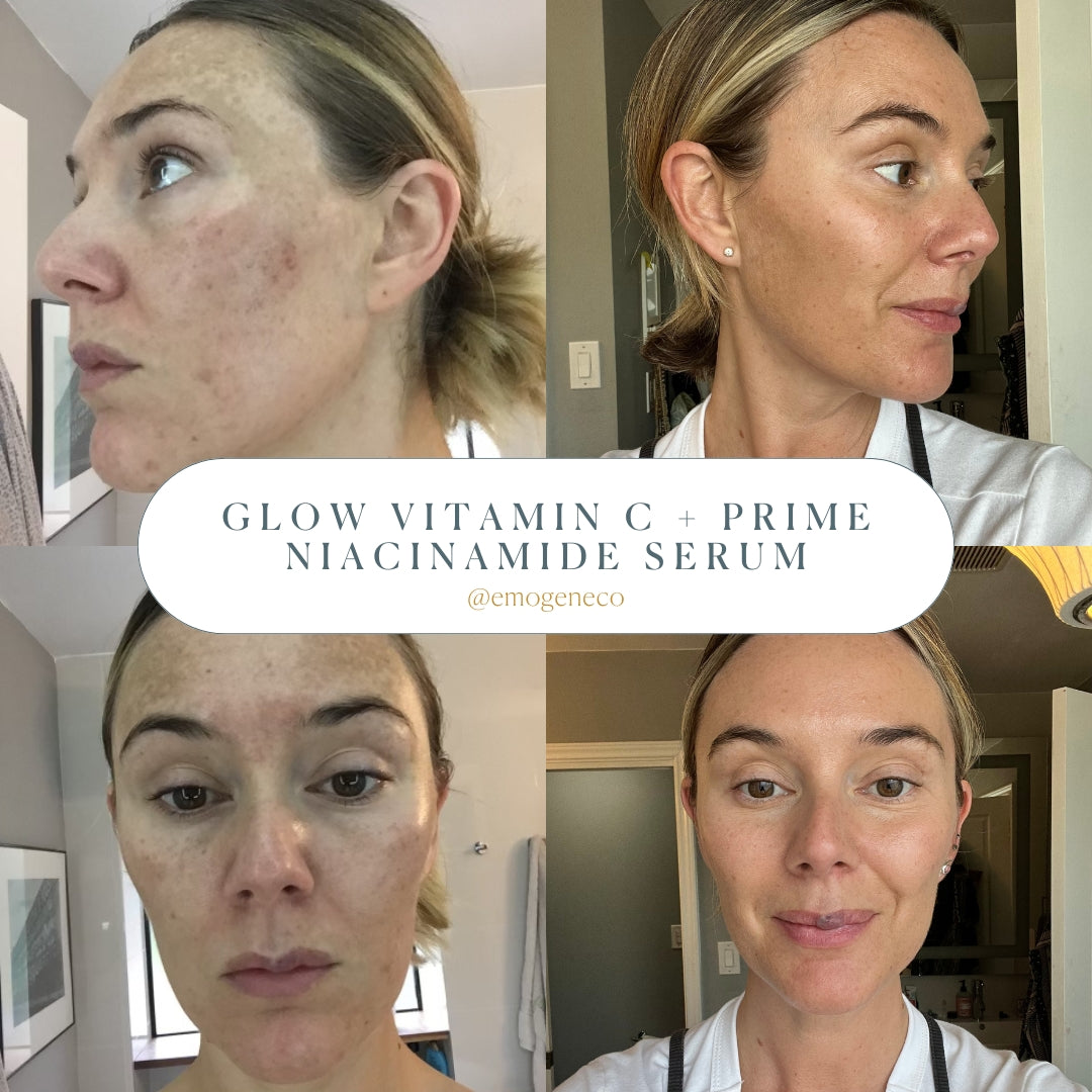 Glow Vitamin C Serum